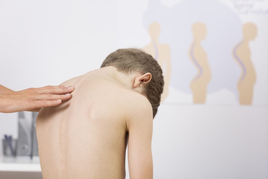 young boy getting tested for scoliosis